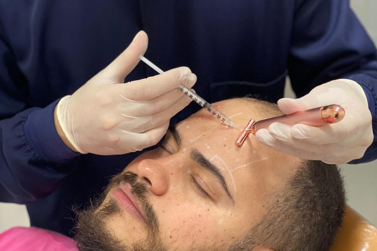 notícia Botox Preventivo: Prevenção e Naturalidade com Dr. Nélio Novaes