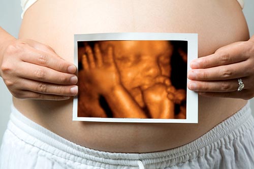 notícia Uma Eco Tridimensional 