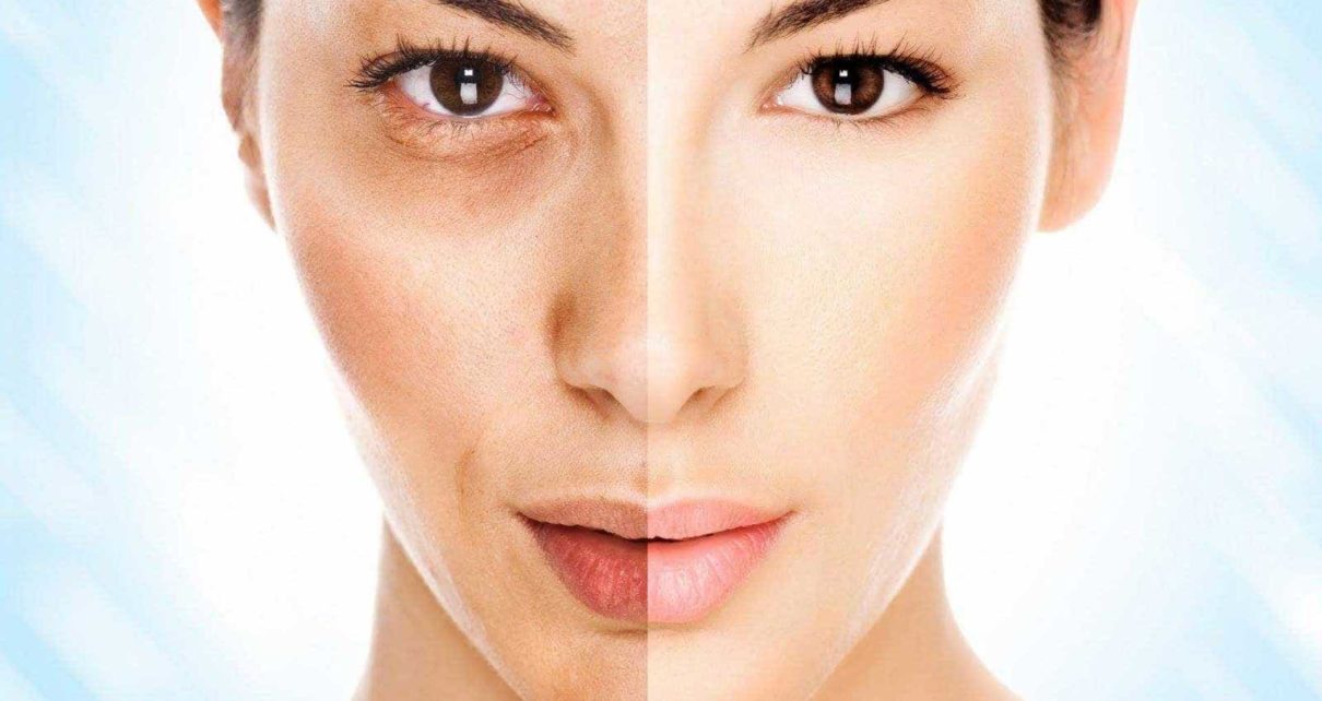 notícia A poluição que desgasta a saúde da pele