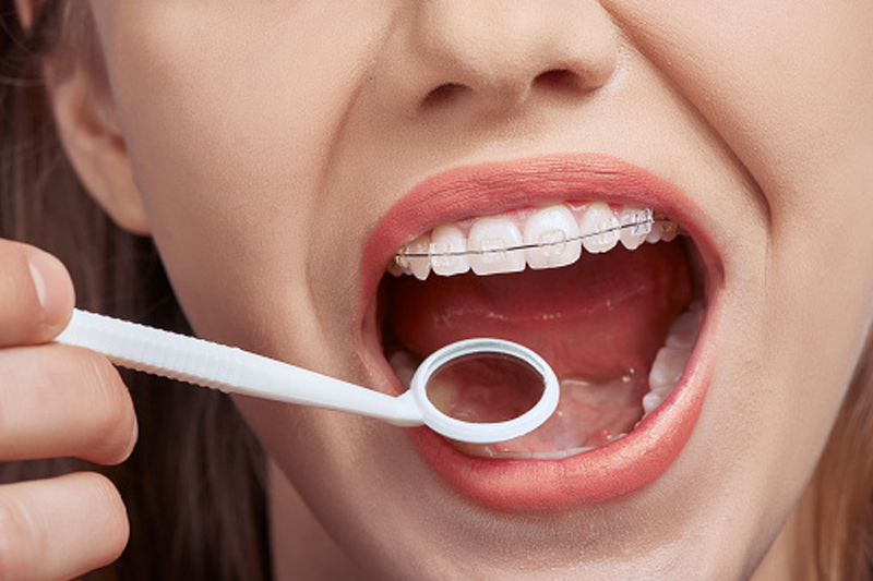 notícia Baixa autoestima e dificuldade em se relacionar podem estar ligadas ao sorriso