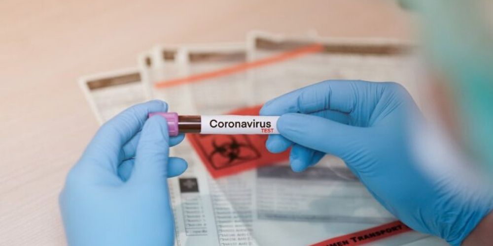 notícia Plataforma de relacionamento viabiliza a realização de testes do COVID-19