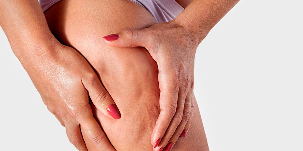 notícia Alimentação saudável e equilibrada ajuda a evitar celulites