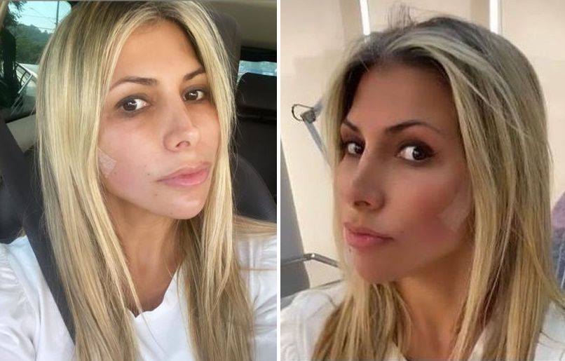 notícia Fernanda Comora realiza procedimentos estéticos para estreia de novo programa de TV