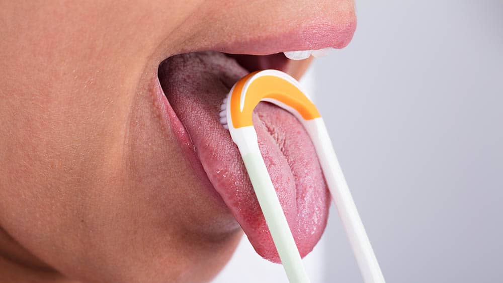 notícia Bolinhas amarelas na garganta? É preciso cirurgia?