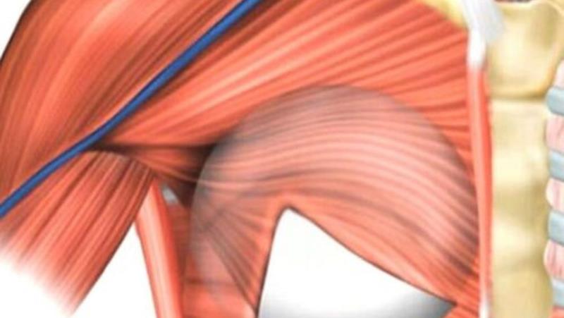 notícia Descubra o R24R, um inovador implante mamário de silicone que permite retomar as atividades do dia a dia apenas 24 horas após a cirurgia