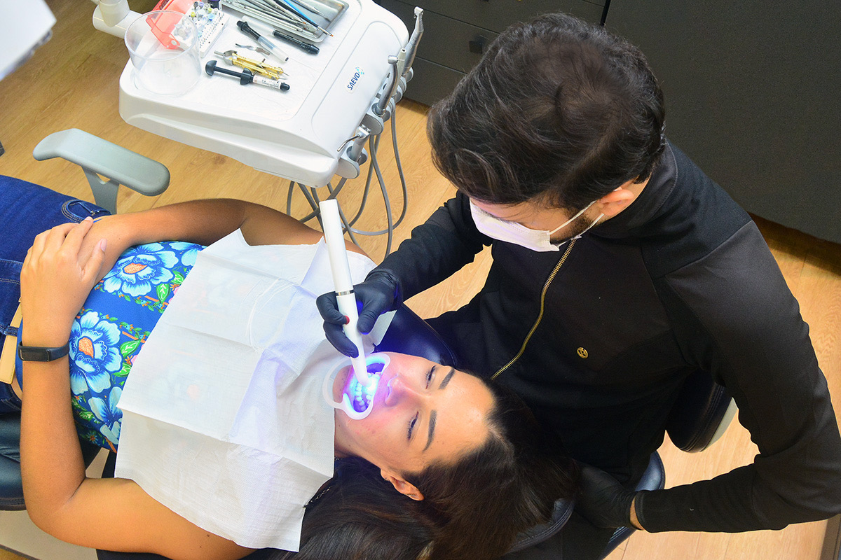 notícia Folia sem medo de sorrir: procura por facetas de resina aumenta às vésperas do Carnaval