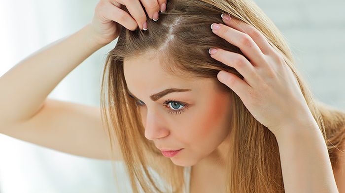 noticia Calvície feminina: a mulher pode ficar careca