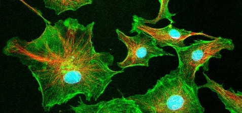 noticia Controle das citocinas inflamatórias no contexto Odontológico através da Biofotônica